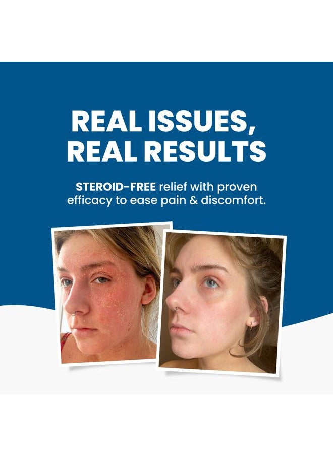 C+ Eczema Cream Dermatitis Treatment - Lotion for Extremely Dry Skin, Inflammation, Redness & Itch Relief - Manuka Honey & Calendula - Clinically Proven - Steroid-Free (1 x 1.76oz)