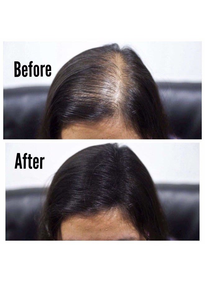 THICK FIBER Hair Fibers for Thinning Hair & Bald spots (BLACK, Pack of 3) - 25g Bottle - Conceals Hair Loss in Seconds - Hair Powder For Women & Men
