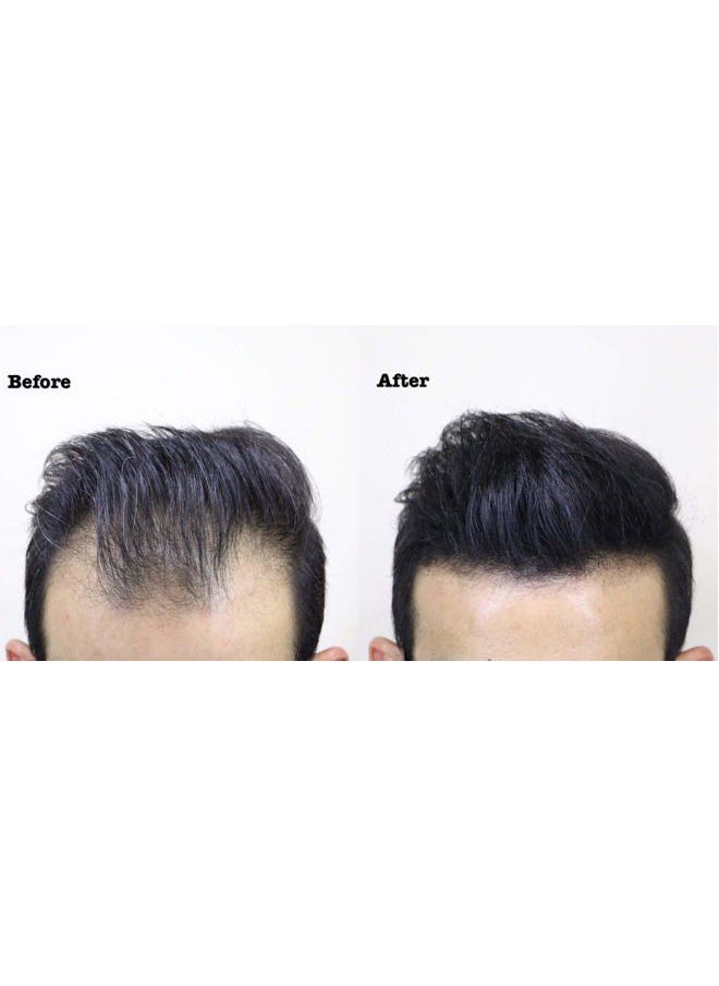 THICK FIBER Hair Fibers for Thinning Hair & Bald spots (BLACK, Pack of 3) - 25g Bottle - Conceals Hair Loss in Seconds - Hair Powder For Women & Men