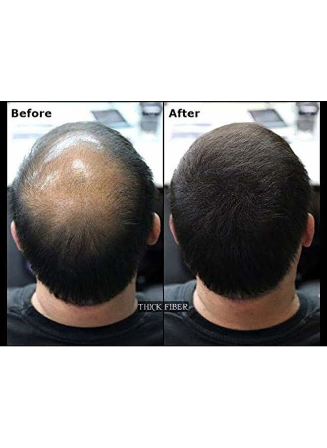 THICK FIBER Hair Fibers for Thinning Hair & Bald spots (BLACK, Pack of 3) - 25g Bottle - Conceals Hair Loss in Seconds - Hair Powder For Women & Men