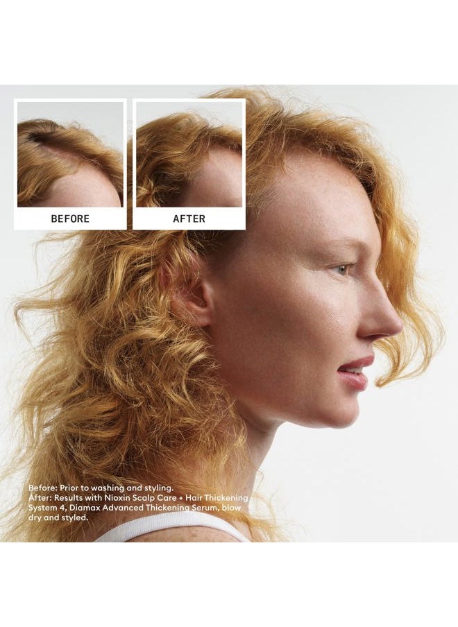 System 4 Scalp Care + Hair Thickening Leave-In Treatment | For Colored, Dry, & Damaged Hair with Progressed Thinning | Nourish & Boost Hair Density with Niacinamide & Biotin | 6.8 Fl Oz