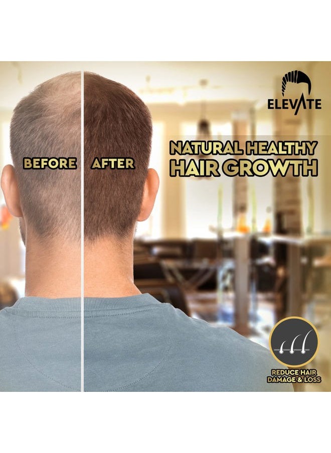 ELEVATE Hair Growth Oil - Biotin Serum & Castor Oil Natural Vitamin Treatment for Stronger, Thicker, Longer Hair and Regrowth - Prevent Thinning and Loss for Men & Women, 1 Fl Oz