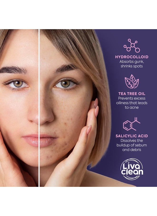 Star Pimple Patches for Face w/Hydrocolloid, Salicylic Acid & Tea Tree, 240 Patches, Hydrocolloid Acne Patch, Cute Star Pimple Patch for Healing Stickers Zit Superstar