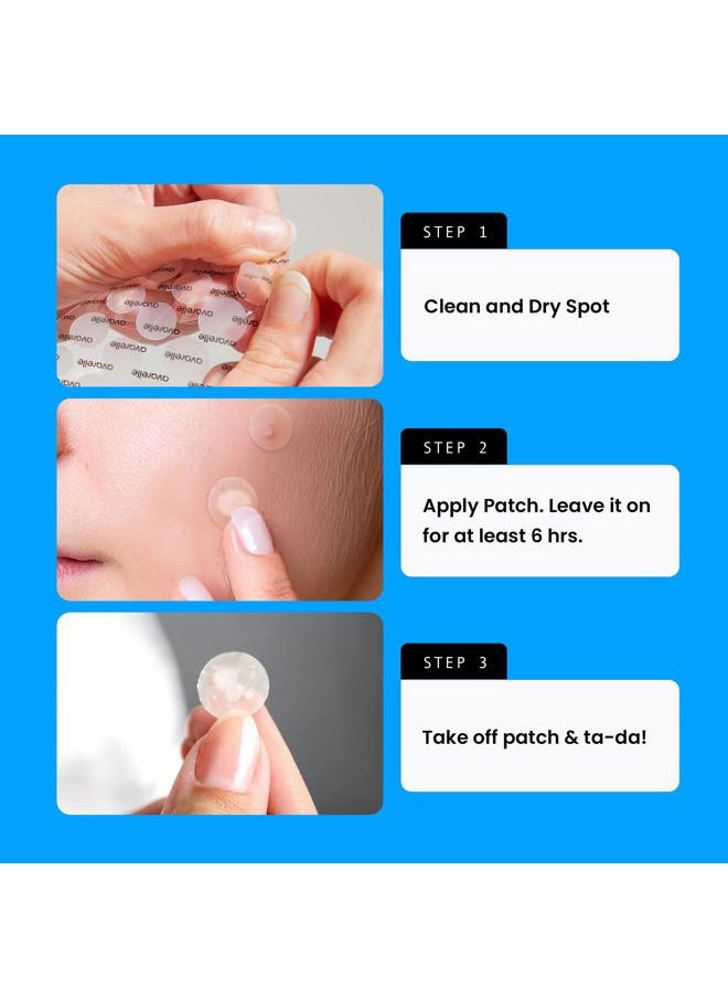 Acne Cover Patches, FSA HSA Eligible Hydrocolloid Pimple Patches for Face with Tea Tree Oil, Korean Skincare Zit Patches for Face | FSA HSA Store Eligible Items | Vegan, Cruelty-free