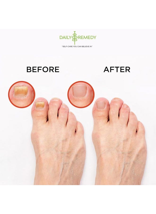 Muscle Relief Foot Soak with Epsom Salt, Made in USA, Soothe Tired Feet, Softens Calluses and Helps Athletes Foot 1lbs