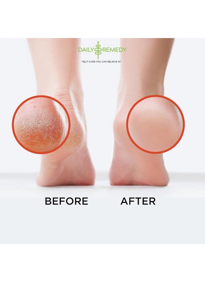 Muscle Relief Foot Soak with Epsom Salt, Made in USA, Soothe Tired Feet, Softens Calluses and Helps Athletes Foot 1lbs