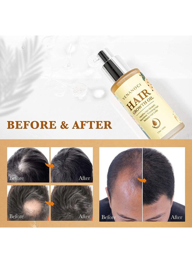 Biotin, Castor & Rosemary Oil for Hair Growth for Women, hair loss treatments for dry damaged hair and growth, Serum for Thicker Longer Fuller Healthier Hair, All Natural Vitamin Rich Treatment