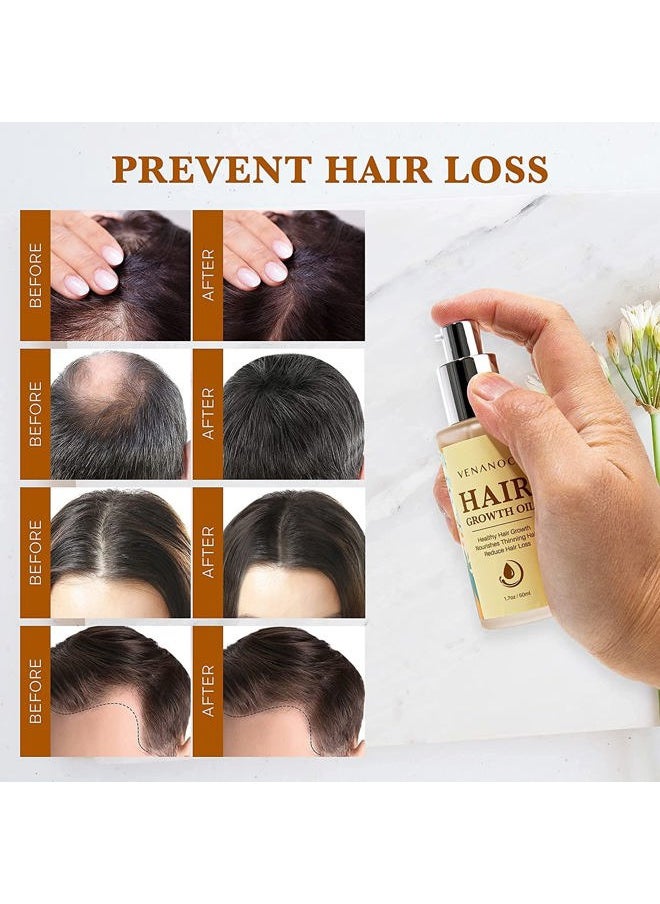 Biotin, Castor & Rosemary Oil for Hair Growth for Women, hair loss treatments for dry damaged hair and growth, Serum for Thicker Longer Fuller Healthier Hair, All Natural Vitamin Rich Treatment