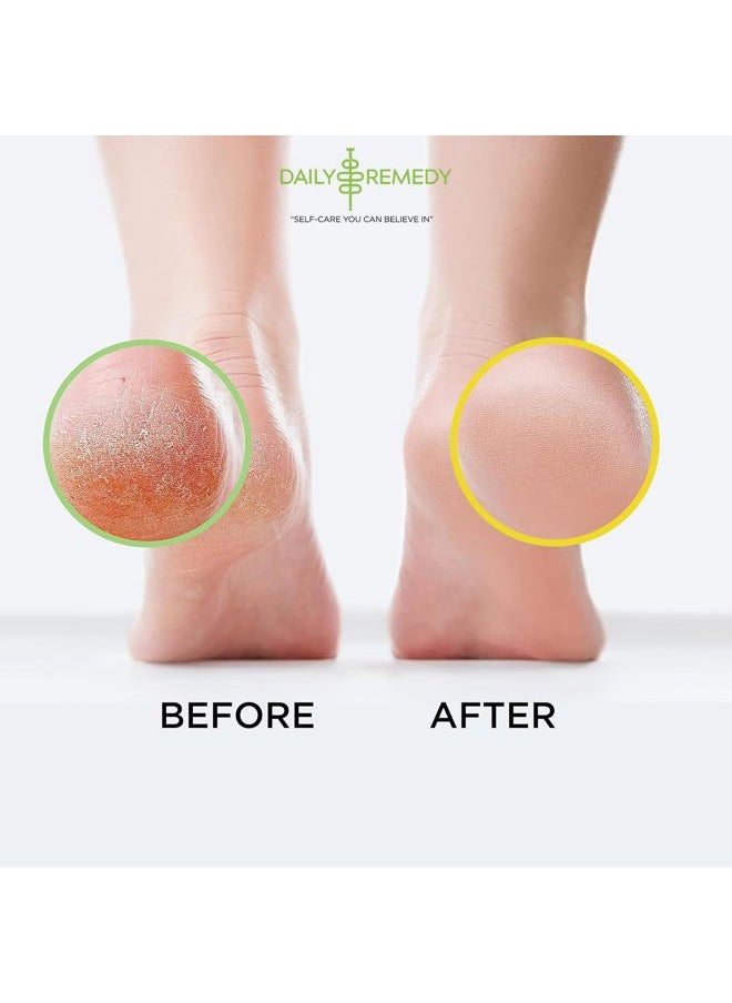 Tea Tree Oil & Citrus Foot Soak Set, Pack of 2, for Foot Pain, Odor, Sore Feet, Athlete's Foot, Soften Calluses - Natural Blend & Salts, Made In USA