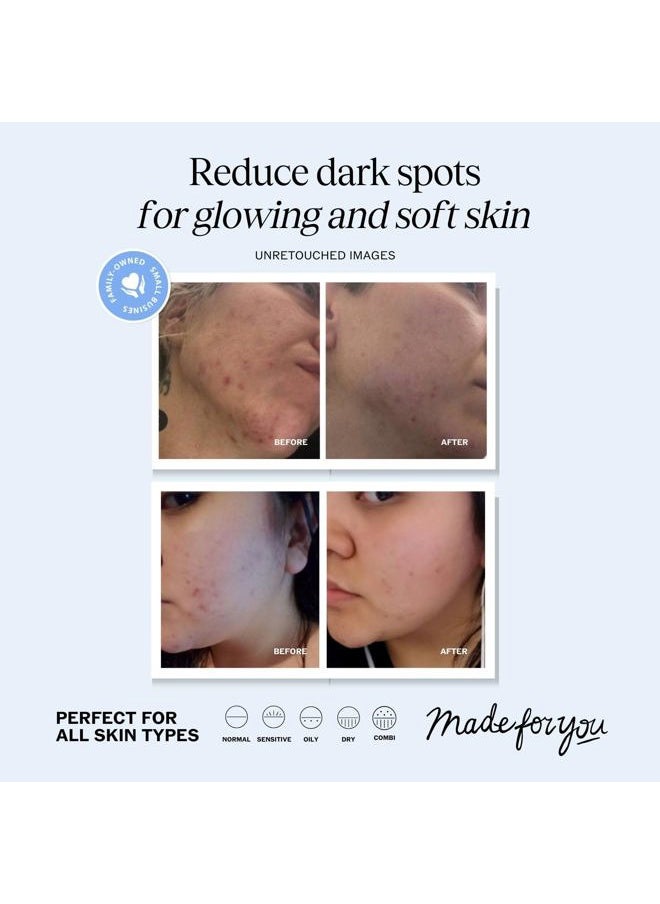 Vitamin C Serum for Face with Hyaluronic Acid and Vitamin E, Anti Aging Serum, Reduces Age Spots and Sun Damage, Promotes Collagen and Elastin (1oz)