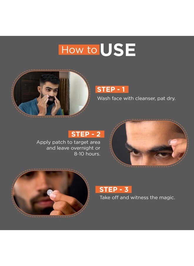 Beardhood Acne Pimple Patch | 72 Hydrocolloid Waterproof Patches | For Active Surface Acne | Absorbs Pimple Overnight, Reduces Excess Oil | For All Skin Types