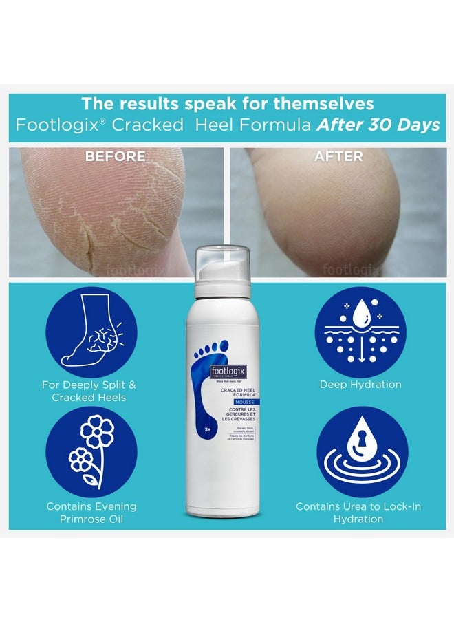 FOOTLOGIX Cracked Heel Formula, White 4.23 Ounce