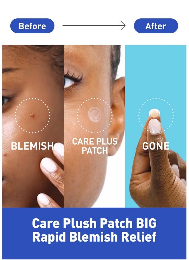 OLIVE YOUNG Care Plus Spot Patch 1 Pack | Hydrocolloid Acne Korean Spot Patch to Cover Zits, Pimples and Blemishes, for Troubled Skin and Face (102 Count - 10mm*72ea + 12mm*30ea)