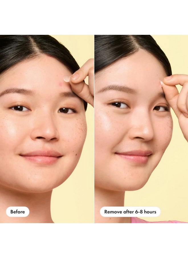 Hero Cosmetics Mighty Patch™ Mini Invisible+ Patches - Extra Small Daytime Hydrocolloid Acne Pimple Patches for Covering Zits and Blemishes, Blends Into Skin and Barely There (30ct 10mm Patches)