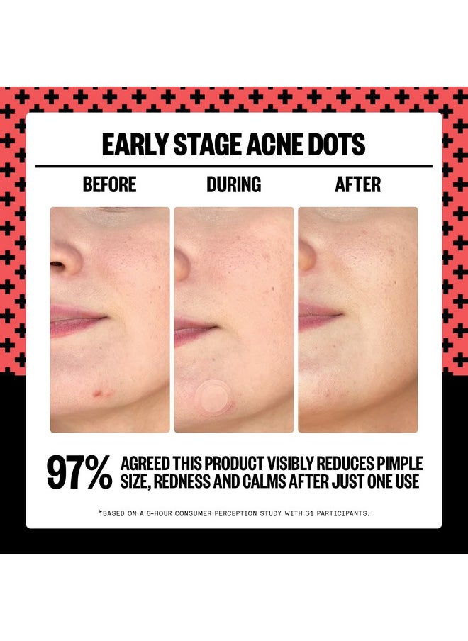 PEACE OUT Early Stage Acne Dots, Acne-Fighting Pimple Patches, Salicylic Acid Unclogs Pores and Targets Acne Blemishes, (8 Acne Dots)