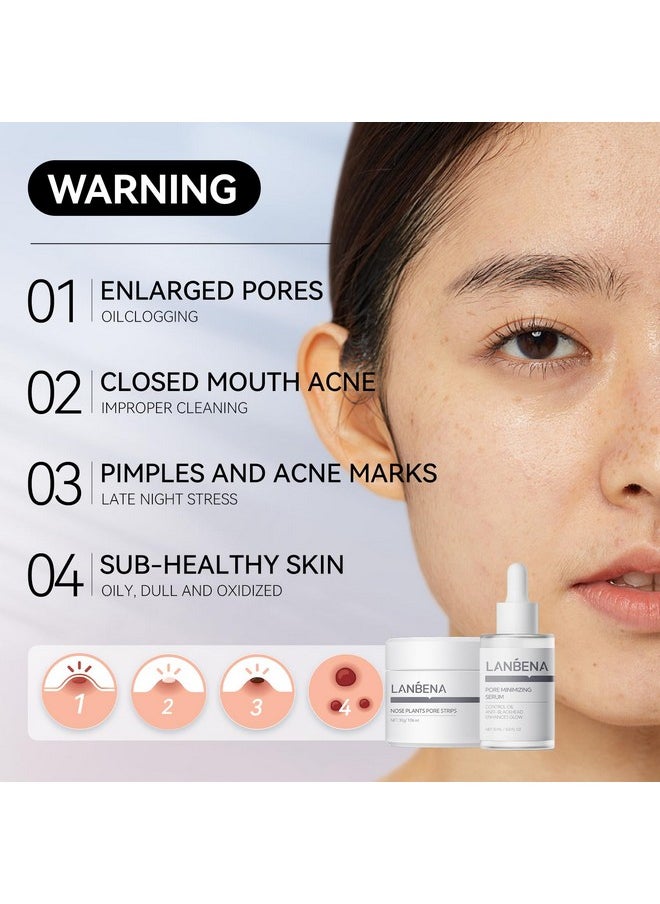 LANBENA 3-in-1 Blackhead Removal Set - Pore Strips (30g), Pore Minimizing Serum (30ml) & Removal Paper - Mask for Face, Minimizes Pores & Leaves Skin Fresh & Clean, Blackhead Remover
