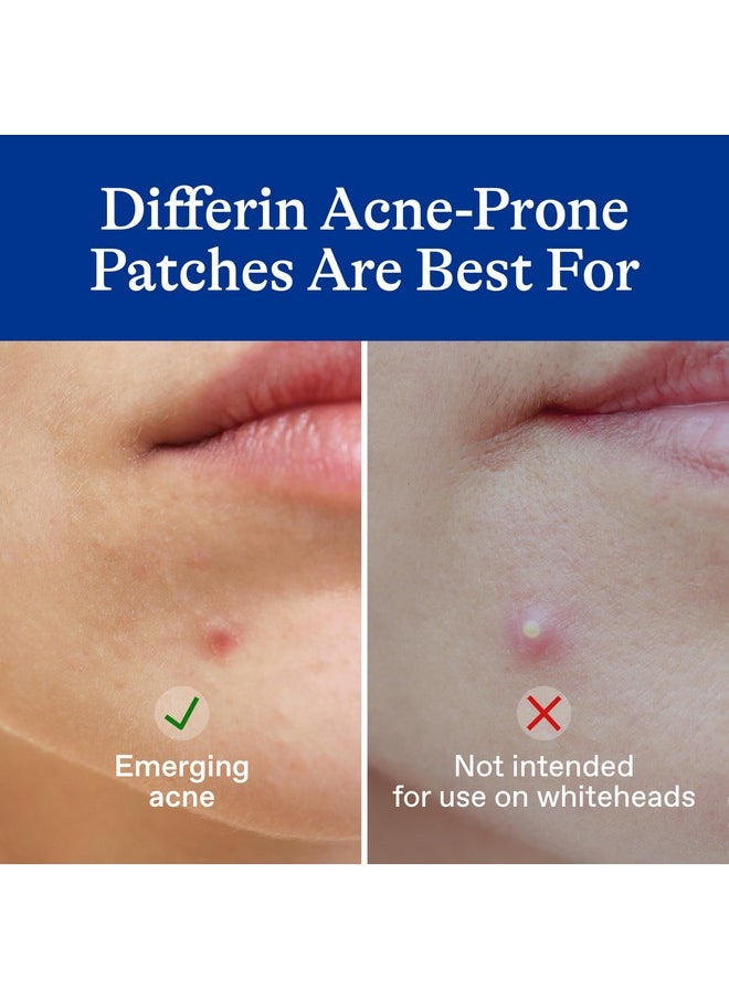 Differin Acne Patches, Pimple Patches for Acne Prone Skin, Formulated with Salicylic Acid and Centella, Fast Triple Action Power Patch for Day & Night, Dermatologist Tested, 36 Count