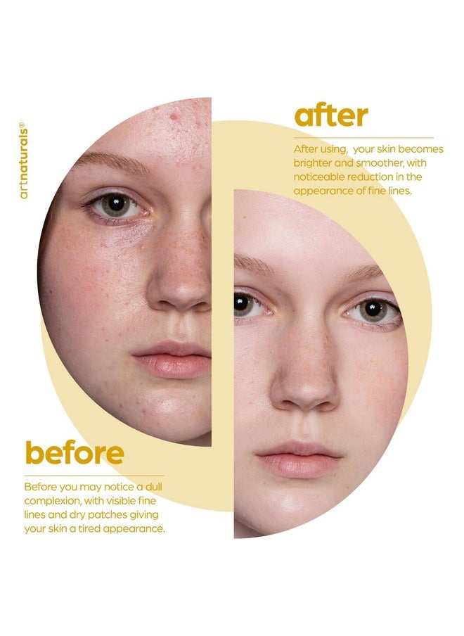 artnaturals Lactic Acid plus AHA Face Serum for Brightening Boost with Renewing Formula - Scars, Acne, Wrinkles - Exfoliates and Moisturizes the Skin - 1 oz.