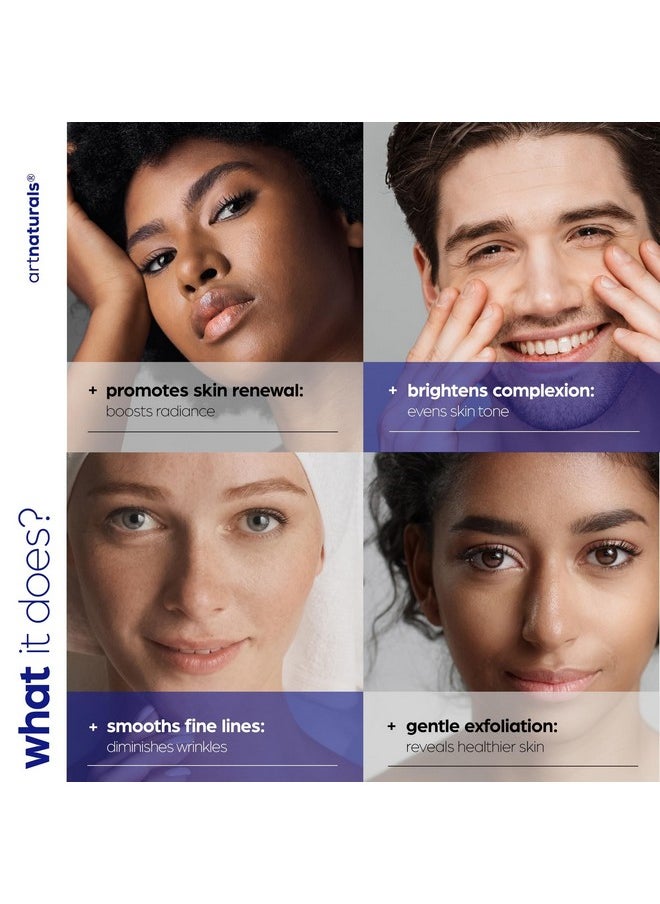 artnaturals Glycolic Serum - Face Serum - Vitamin C and Aloe Vera - Exfoliates and Minimizes Pores, Reduce Acne, Breakouts, and Appearance of Aging and Scars -1 oz.