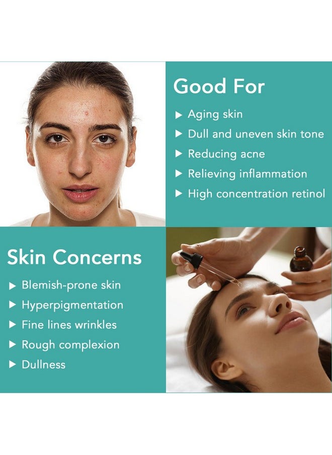 Retinol Serum - Retinol Liposome Delivery System with Hyaluronic Acid and Vitamin E, Aloe, Anti Aging Retinol Serum for Skin Repair, Fine Line and Wrinkles