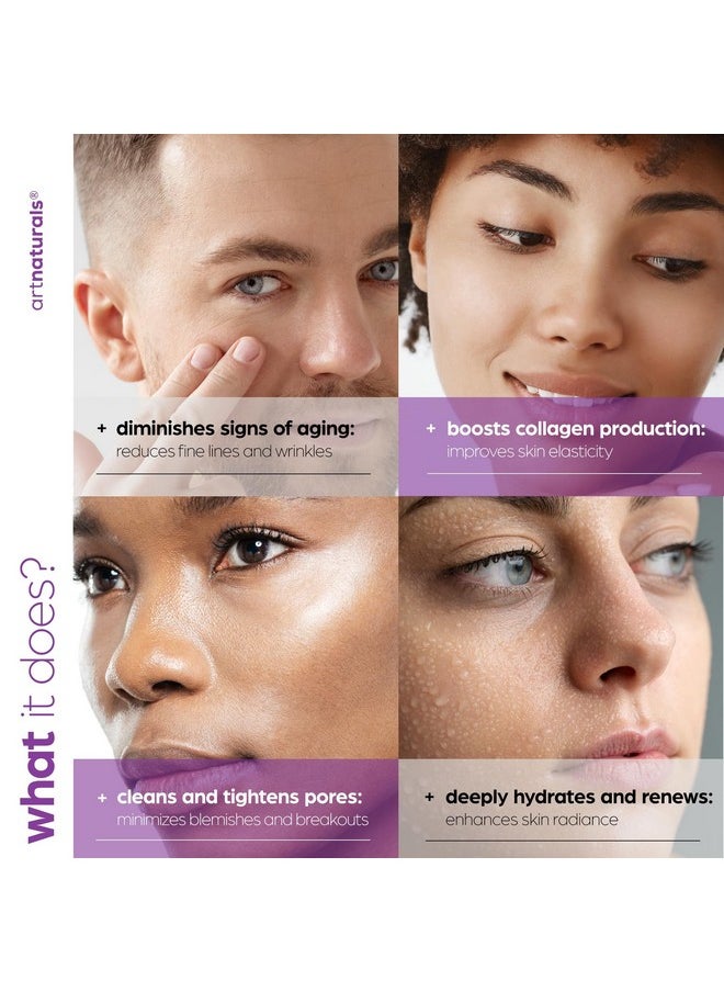 ArtNaturals Retinol Serum for Face - with Vitamin C, 2.5% Retinol Oil & Hyaluronic-Acid - Skin Clearing - Anti-Aging, Anti-Wrinkle Eye Serum - Skin Repair, Night Therapy (1 Fl Oz / 30ml) (ANGA-0127)