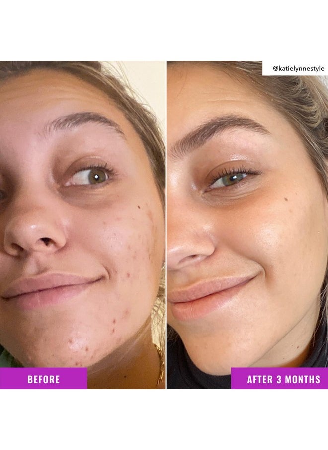 Good Molecules Niacinamide Brightening Toner - Facial Toner with Niacinamide, Vitamin C and Arbutin for Even Tone, Enlarged Pores - Skincare for Face