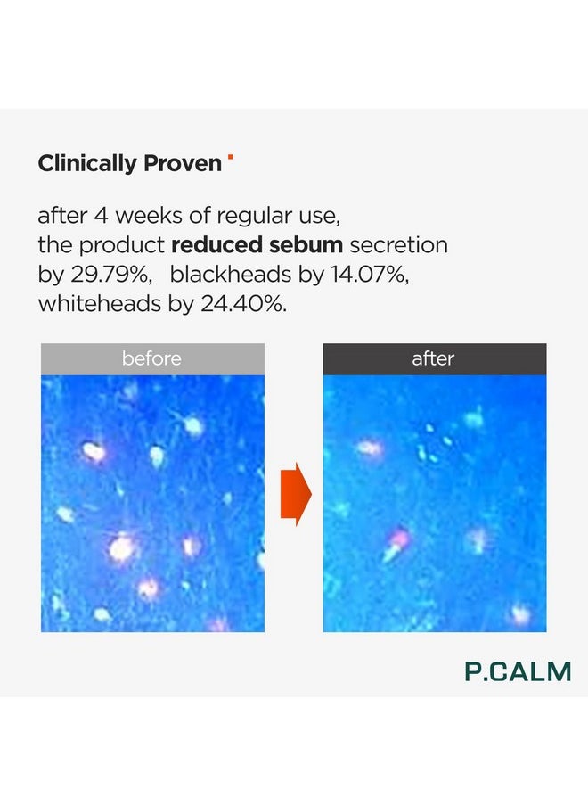 P.CALM Barrier Cycle Toner 200ml | Vegan Alcohol-Free Fragrance-Free Toner for Sensitive Skin | Korean Skincare