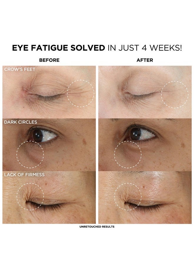 IT Cosmetics Confidence in an Eye Cream, Anti Aging Eye Cream for Dark Circles, Crow's Feet, Lack of Firmness & Dryness, 48HR Hydration with 2% Super Peptide Concentrate, for Day + Night