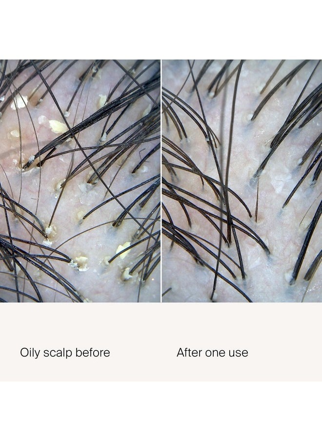 Living Proof Scalp Care Exfoliator