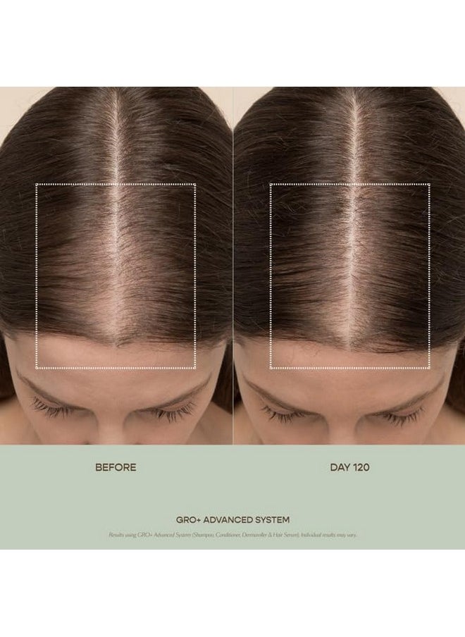 VEGAMOUR GRO+ Advanced Hair Serum for Improving Hair Density, Reduces Shedding and Promotes a Healthy Scalp, 1 pack