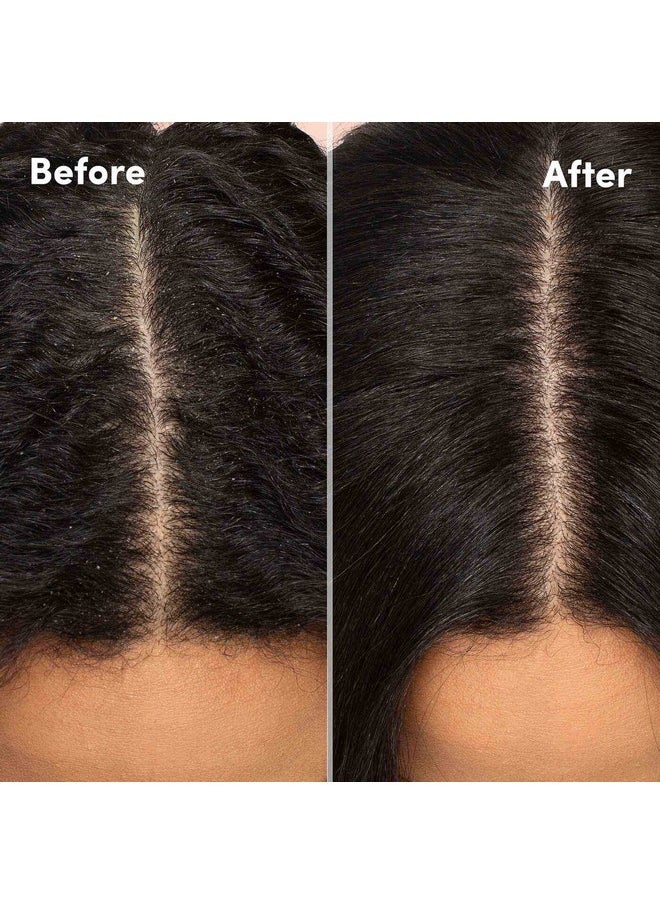 Mizani Scalp Care Calming Scalp Lotion |Dandruff Treatment | Nourishes & Soothes Scalp | For Curly Hair | 4 Fl Oz