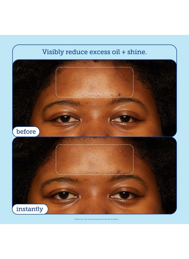 Skinfix Barrier+ Skin Barrier Restoring Gel Cream: Formulated with Niacinamide & Peptides, Ideal for Oily and Blemish-Prone Skin, Restores Skin Barrier, 1.7 oz