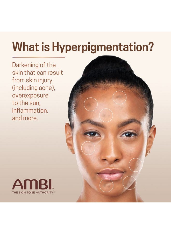Ambi Even & Clear Advanced Fade Cream, Hydroquinone-free, Hyperpigmentation Treatment, Stubborn Dark Spot Corrector, Results In As Little As 2-3 Weeks, Niacinamide, Licorice Root Extract, PHA, 1 Fl Oz