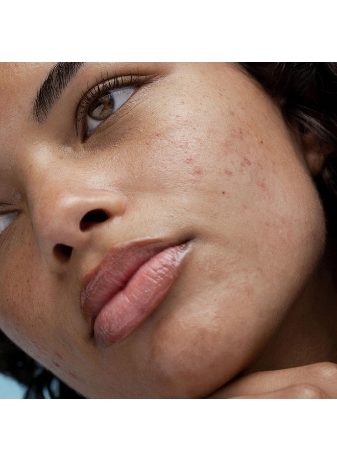 Obagi Rebalance Skin Barrier Recovery Cream - Soothing Postbiotic Moisturizer Reduces Redness with Ceramides and Niacinamide - Suitable for Sensitive Skin with Eczema, Rosacea or Acne - 1.7 oz