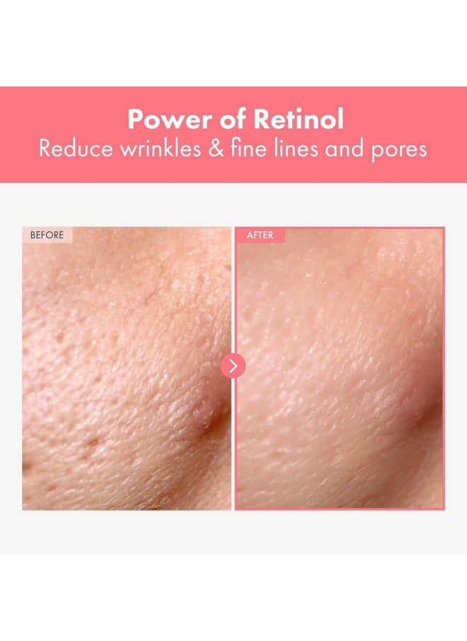 NATUREKIND Repair Retinol Cream, Liposomal Retinol 0.1%, Bakuchiol, Retinal, niacinamide, Anti Aging for Face, Eye, Fine Lines & Wrinkles Treatment, Pure Vitamin A, Korean Skincare, 50g, 1.76 oz.