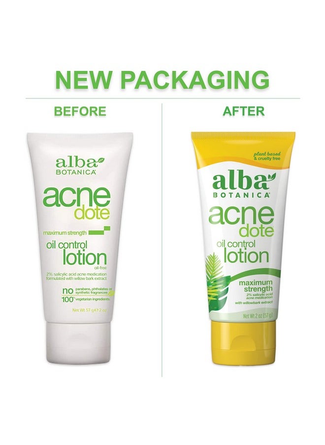 Alba Botanica Acnedote Maximum Strength Oil Control Lotion, 2 Oz