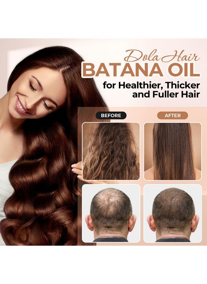 Batana Oil for Hair Growth Organics 100% Natural Pure Batana Hair Oil Batana Oil Nourishes Damaged Hair raw Batana Butter Prevent Hair Loss Natural Hair Growth Oil and Conditioner