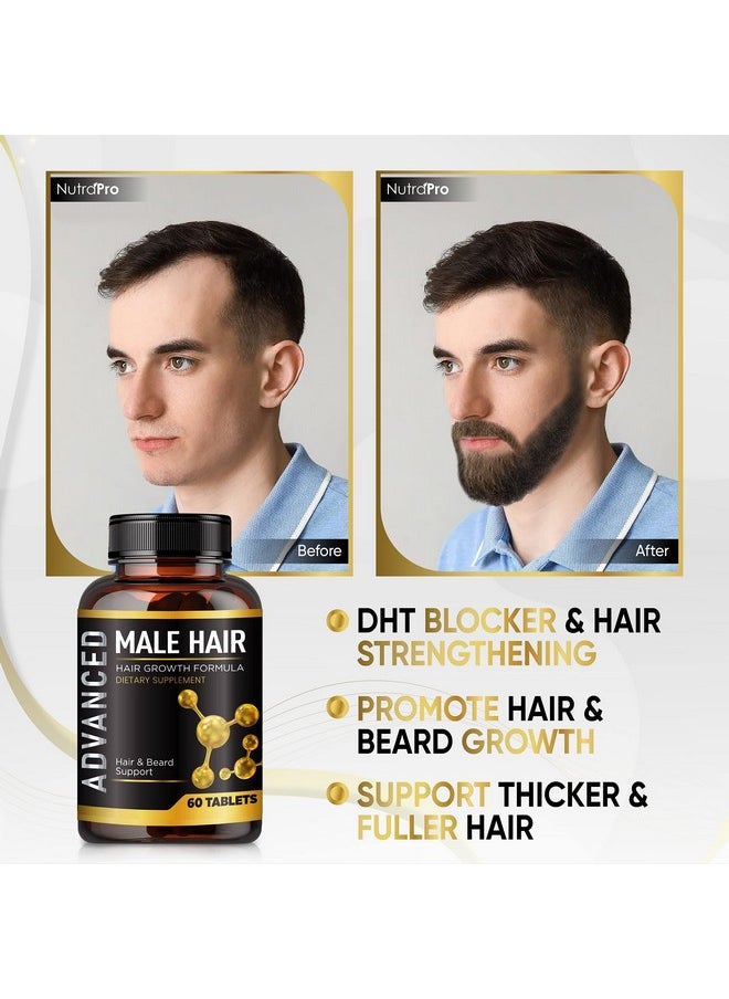 Hair Growth Vitamins For Men-Anti Hair Loss Support Vitamins Pills & Dht Blocker For Men.Regrow Hair & Beard Growth Supplement For Thicker Fuller & Stronger Hair. Support Thinning Hair With Biotin.
