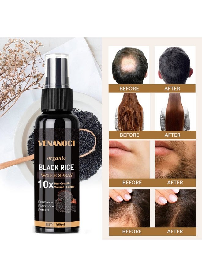 Venanoci Hair Growth Serum, Rice Water Spray for Women & Men Treatment For Hair Loss, Damaged Dry Hair, Hair Regrowth for Thicker Longer Fuller Hair with Castor oil Ginger