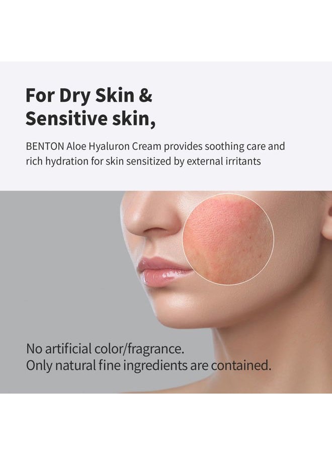 Aloe Hyaluron Cream 50g (1.76 oz.) - Aloe Leaf Water & Hyaluronic Acid Contained Soothing and Moisturizing Facial Cream, for Dryness and Itchy Senstivie Skin