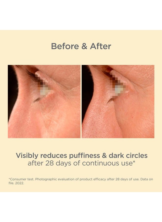 K-Ox Under-Eye Brightening Cream for Puffiness and Dark Circles with Anti-Aging Benefits, Vitamin K and Hyaluronic Acid, visible results in 28 days of usage