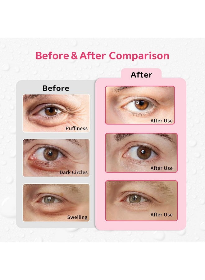 4PCS Gel Eye Ice Pack Set Reusable, Cold and Hot Compress for Eyes, Ice Pack for Eyes, Cooling Eye Pads for Eye Strain, Swelling, Redness, Dark Circles, Puffy Eyes, and Eye Recovery Surgery.