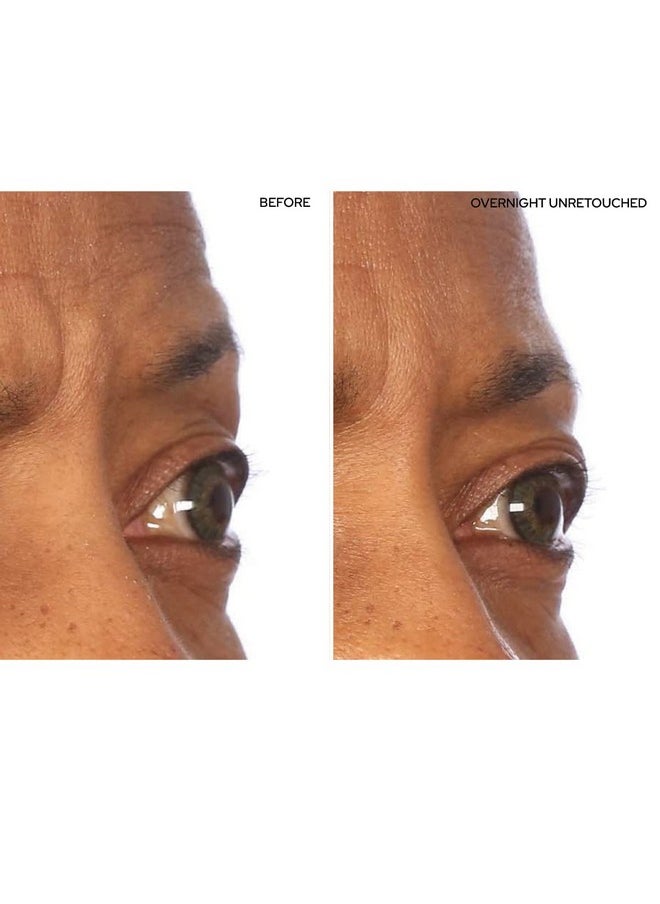 SiO Beauty SuperLift Forehead, Eye, & Lip Anti-Wrinkle Silicone Patches - Reduce Brow, Smile, and Under Eye Wrinkles Overnight