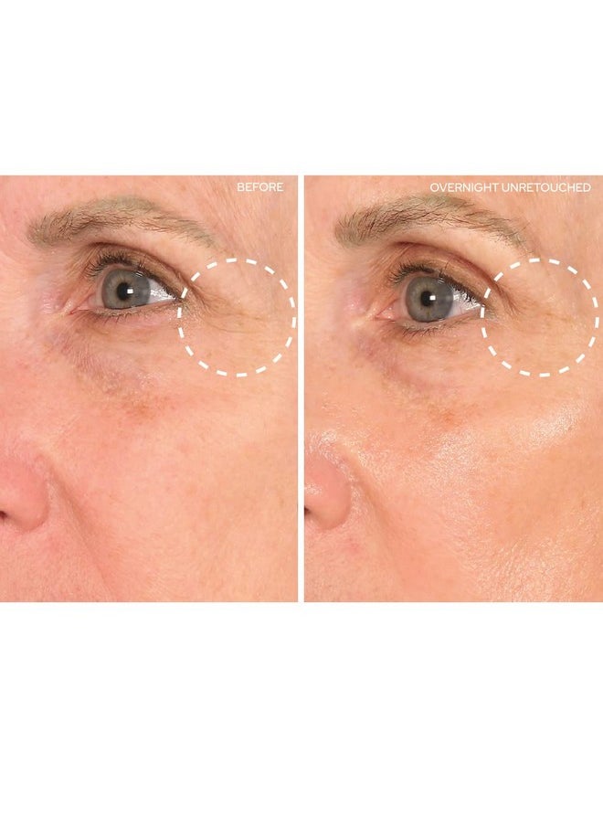 SiO Beauty SuperLift Forehead, Eye, & Lip Anti-Wrinkle Silicone Patches - Reduce Brow, Smile, and Under Eye Wrinkles Overnight