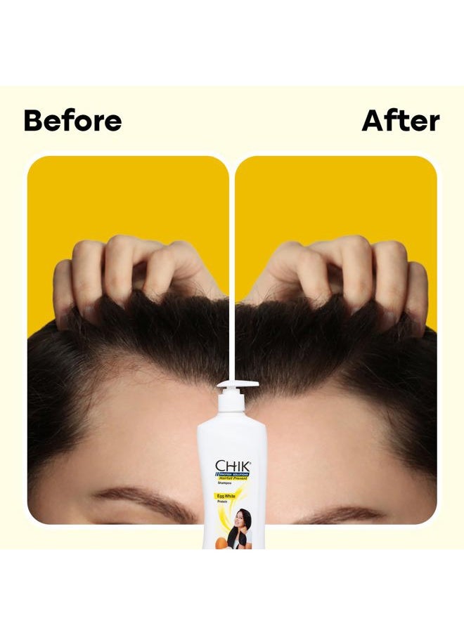 Chik Hairfall Prevent Egg Shampoo, 340ml