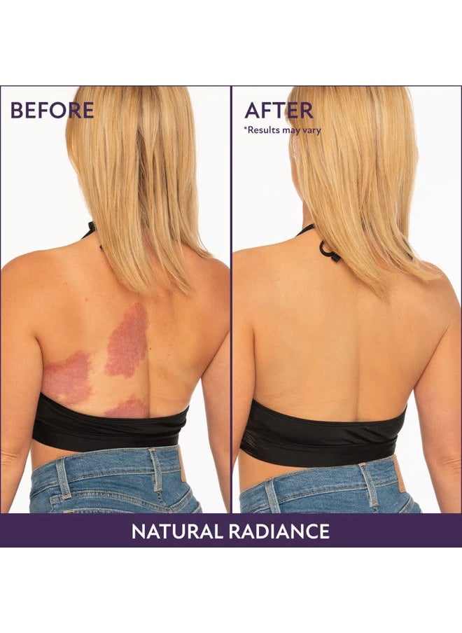 Body Coverage Perfector – Waterproof Leg & Body Makeup - Tattoo Cover Up Makeup - 7 Oz (Warm Radiance)