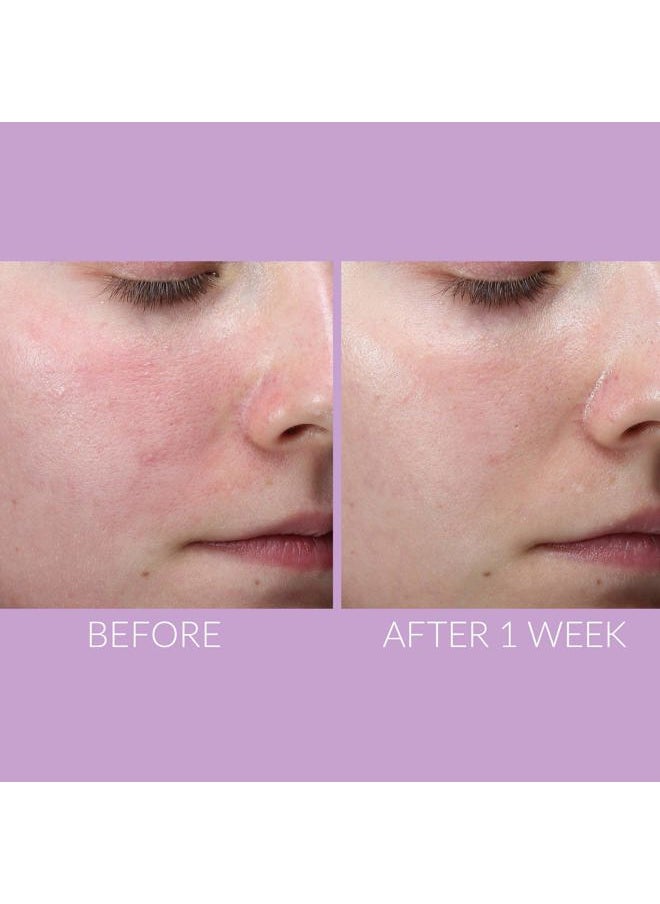 DeliKate Recovery Serum – Clinically Formulated Hydrating Treatment – Irritation and Redness Relief for Stressed or Sensitive Skin, 1 Fl Oz