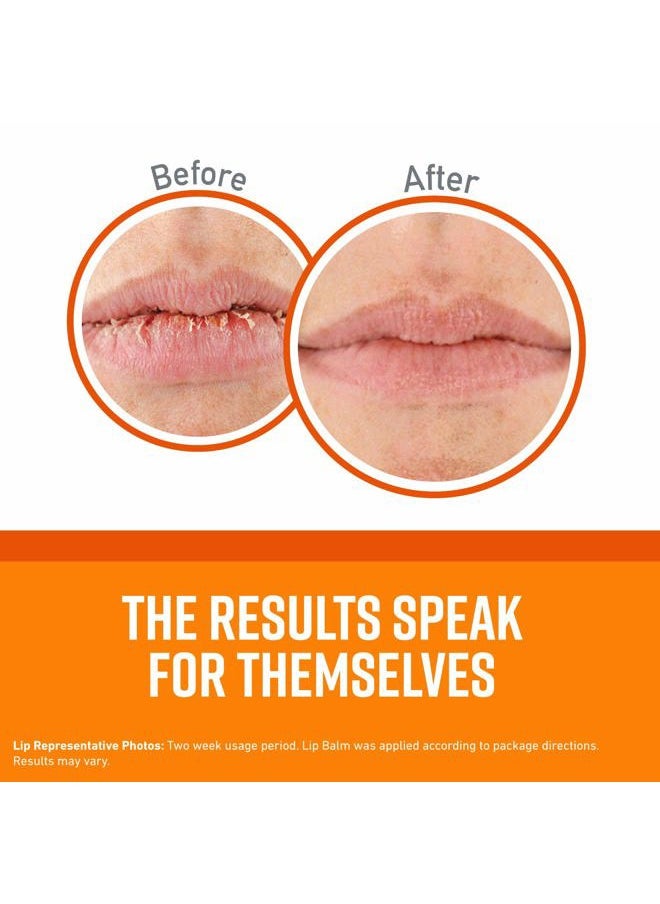 Lip Repair Unscented Lip Balm for Dry, Cracked Lips - Stick (1 Pack) - Moisturizer for Very Dry Lips