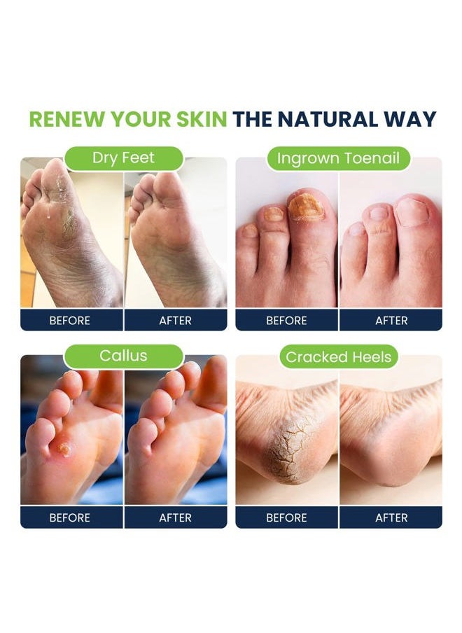 Tea Tree Oil Foot Soak with Epsom Salt - For Toenail Repair, Athletes Foot, Softens Calluses, Soothes Sore & Tired Feet, Nail Discoloration, odor Scent, Spa Pedicure Care - Made in USA 16 oz