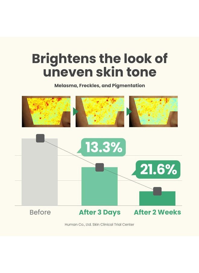 Dark Spot Correcting Glow Serum - 5% Niacinamide Remedy for Dark Spots, Blemish & Freckle Remover - Vegan Korean Skin Care Niacinamide Serum for All Skin Types - 1.69 fl. oz.